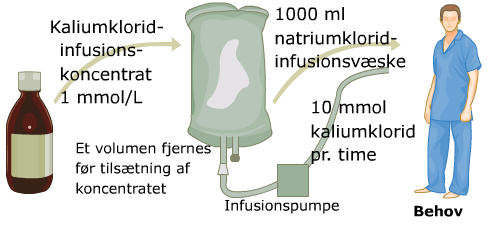 Grafik af patient med behov for infusion med kaliumklorid